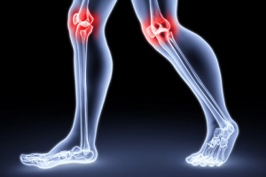 патологии тазобедренного и коленного суставов, двигательные нарушения, продолжительность ходьбы, меры предосторожности